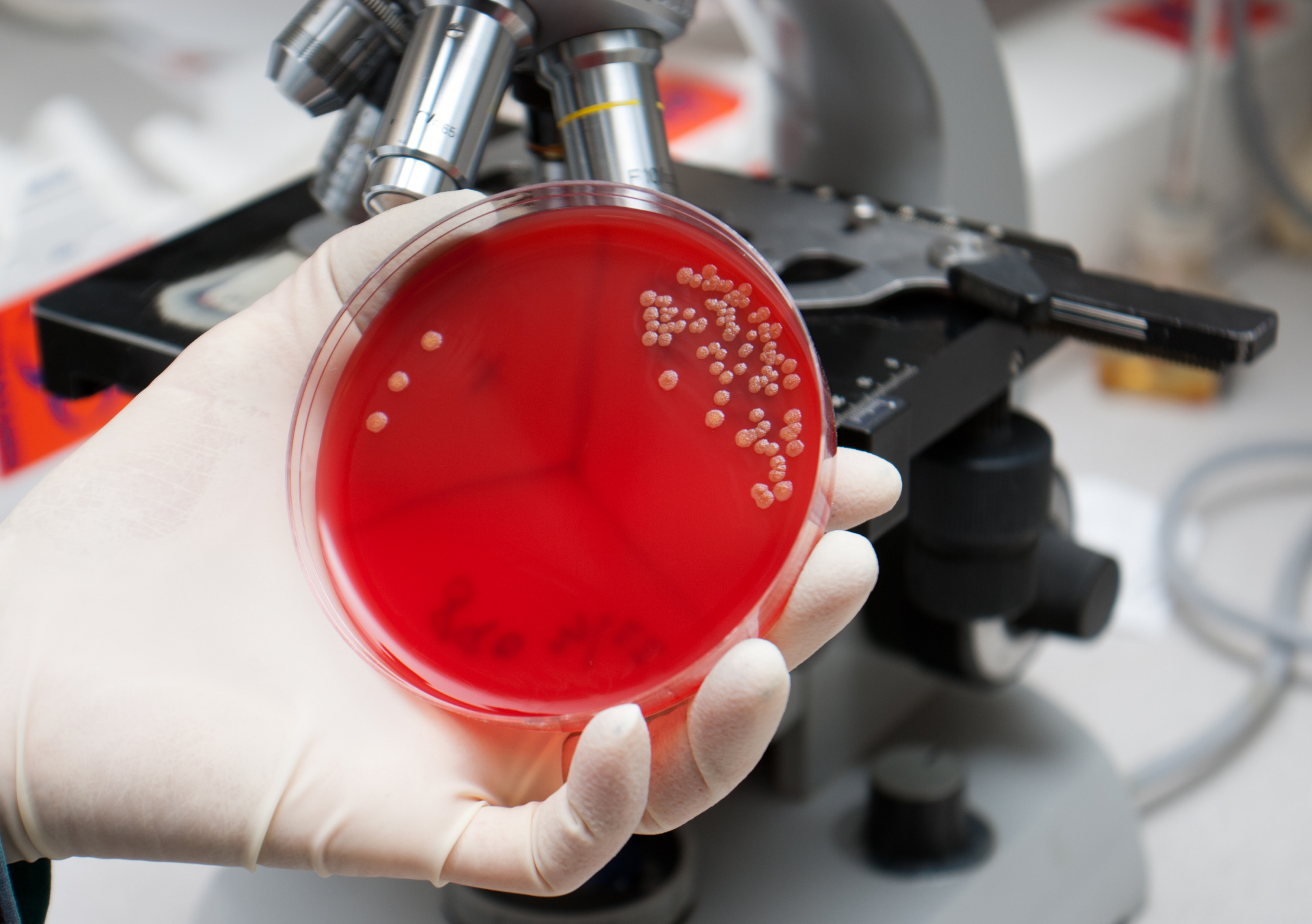 Отдел бактериологии и питательных сред провел более 1100 микробиологических исследований в начале текущего месяца